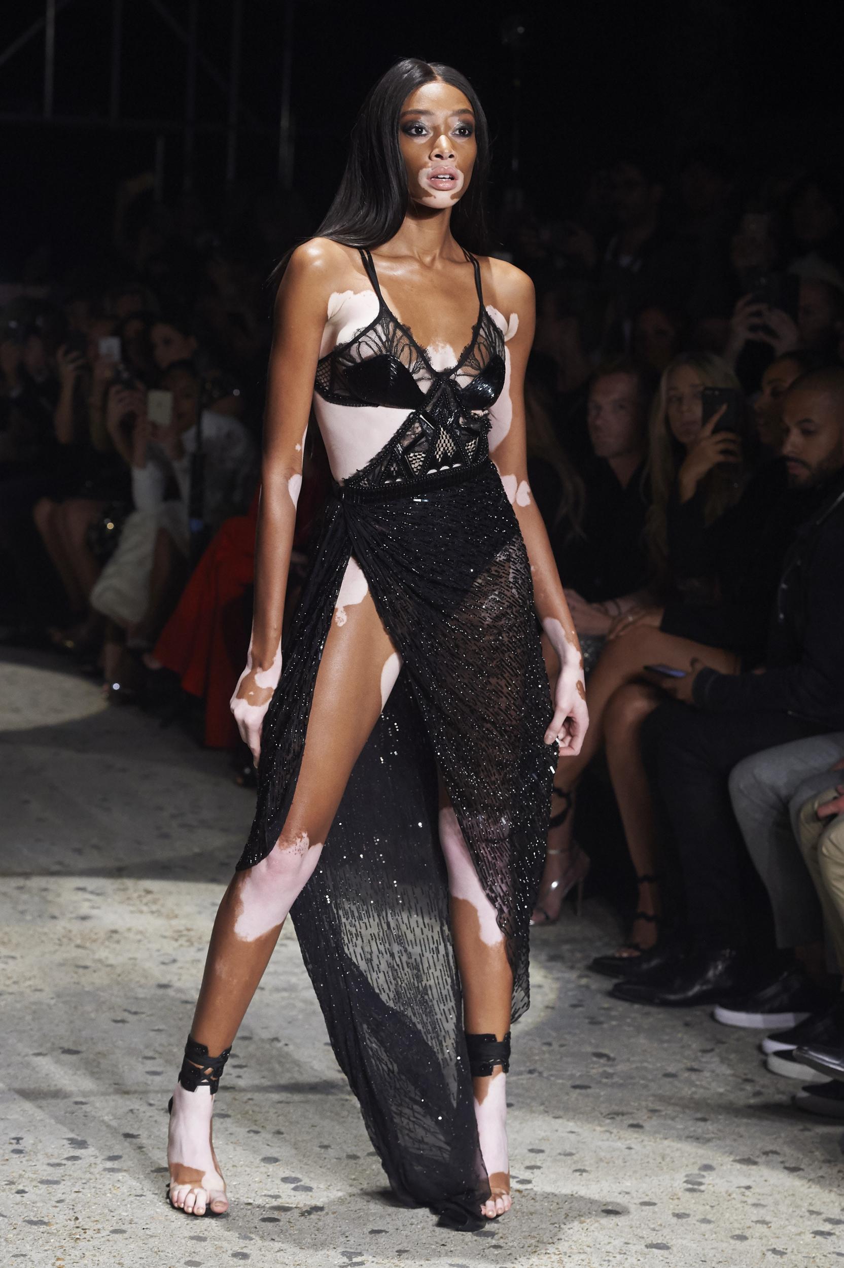 Conoce a Winnie Harlow, la primera modelo con vitíligo que desfilará en el  próximo Victoria's Secret Fashion Show - Hoy Magazine